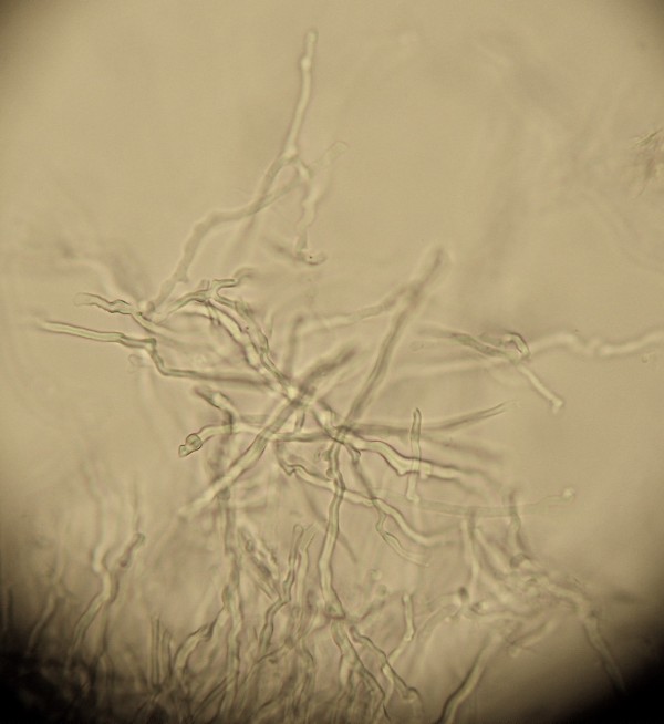 Antrodia? (Antrodia alpina)